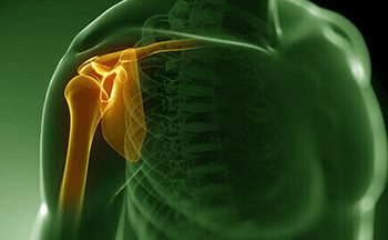 Best Joint replacement surgeries in Bangalore