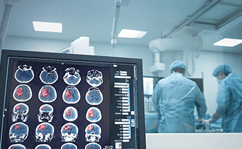 Awake Craniotomy for Brain Tumours | Best Neurosurgeons in India