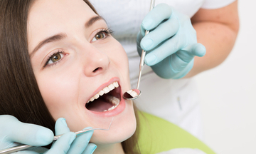 surgical removal of teeth