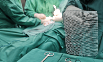 inguinal hernia surgery in bangalore
