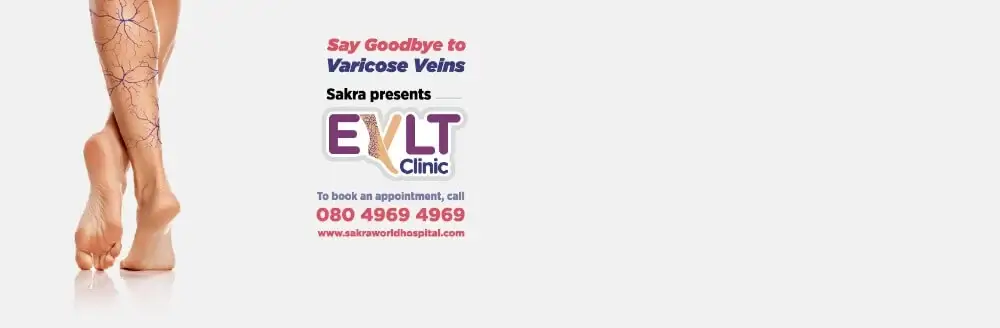 Varicose Vein Treatment 