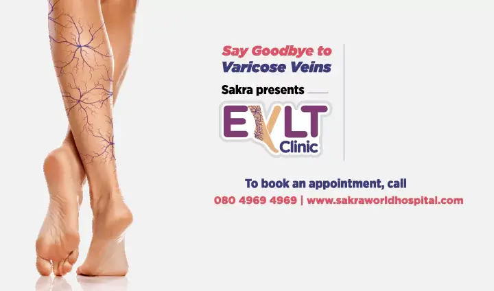Understanding EVLT and its role in treating varicose veins