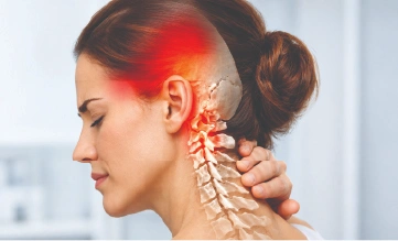 Cervicogenic Headache