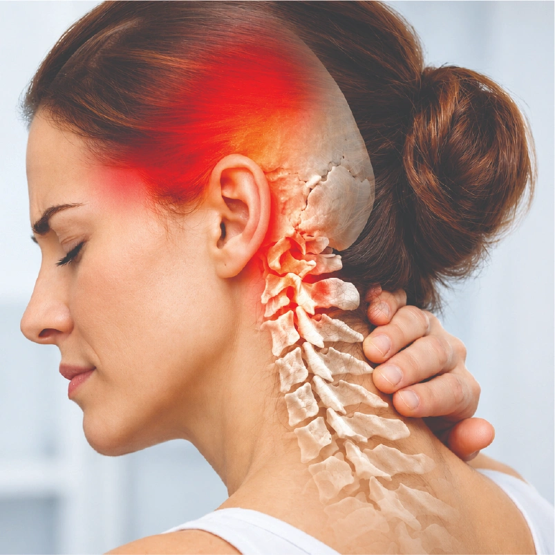 Cervicogenic Headache