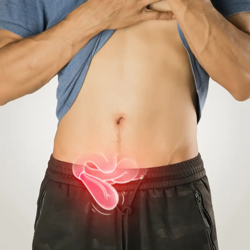 Hernia Repair Surgery