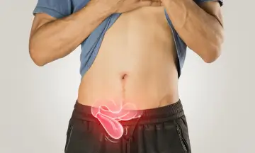 Hernia Repair Surgery