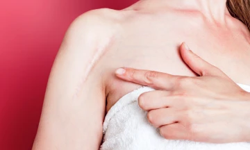How to Remove Scars