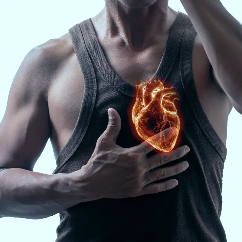 Left Bundle Branch Block