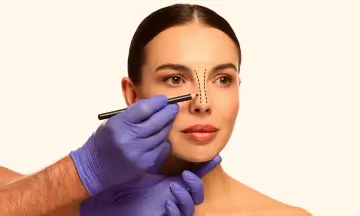 Understanding Rhinoplasty
