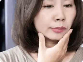 Facial Palsy