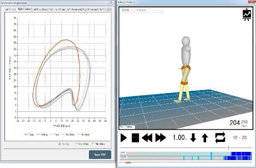 robotic rehabilitation center in bangalore