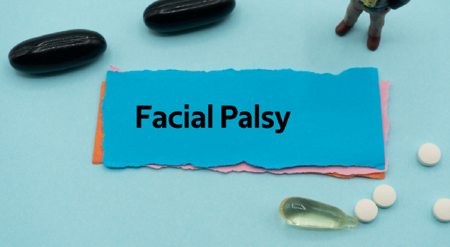Treatment and Causes of Facial Nerve Palsy