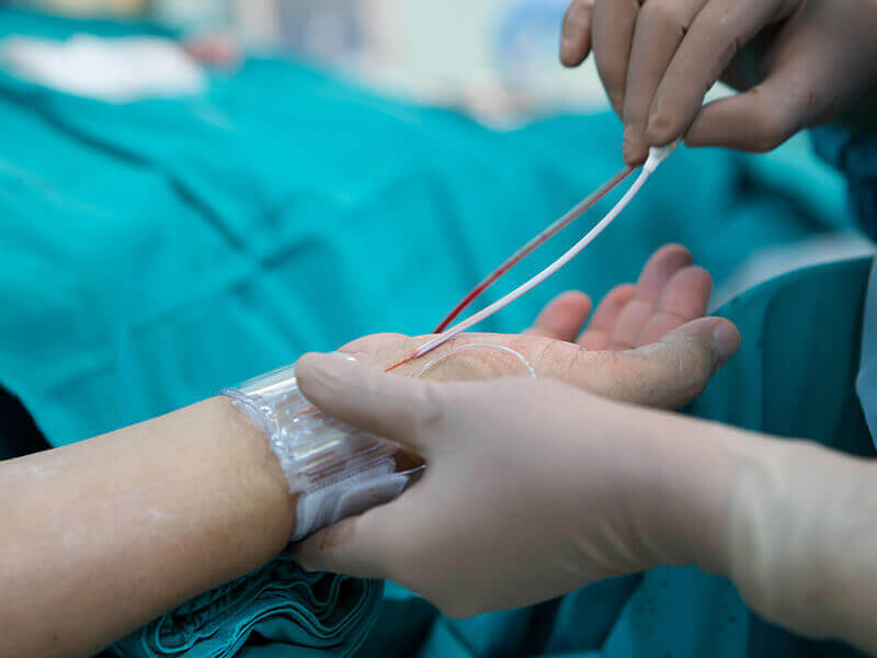 Coronary Angiography Procedure | Coronary Artery Disease Treatment - Sakra  World Hospital