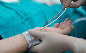 Coronary Angiography Procedure - Sakra World Hospital