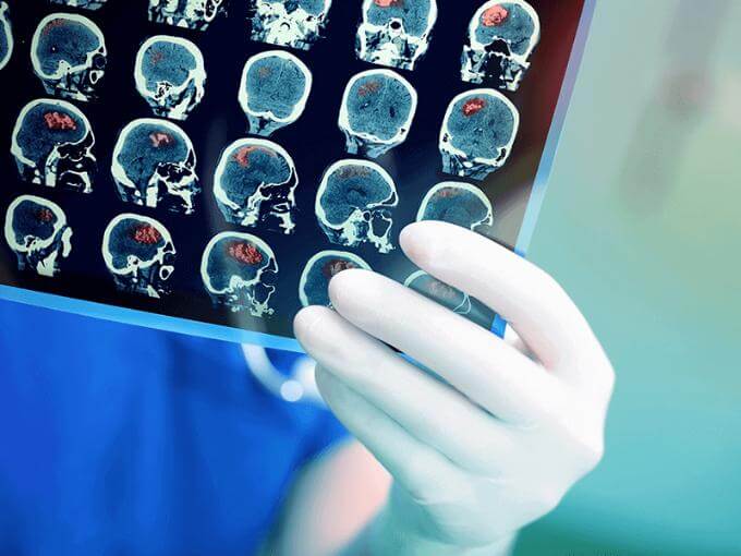 Sakra World Hospital - Patient Reviews |  Brain Tumor Surgeons in Bangalore | Best Neurosurgeon in India