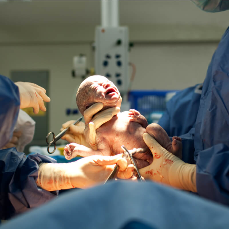 caesarean section surgery in banglore