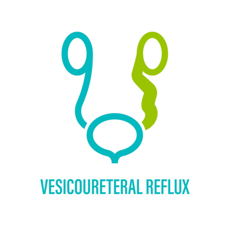 vesicoscopic ureteric reimplantation in bangalore