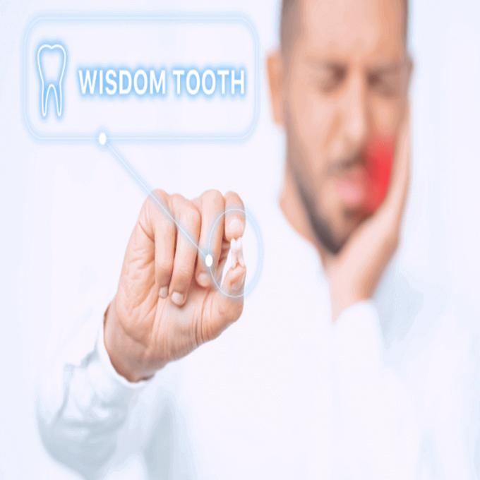 wisdom tooth extraction in bangalore